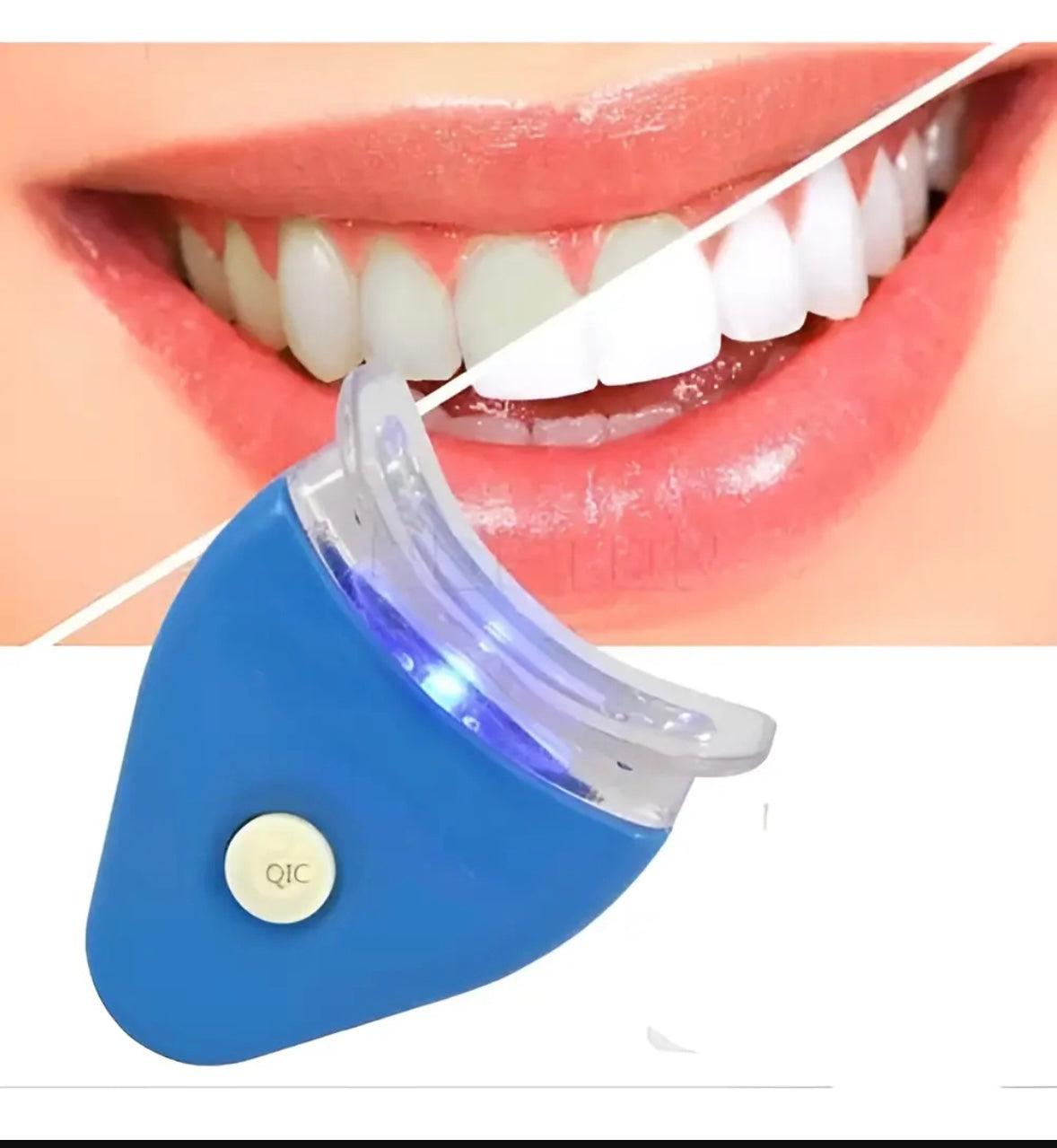 Fynex™ Kit Blanqueador Dental