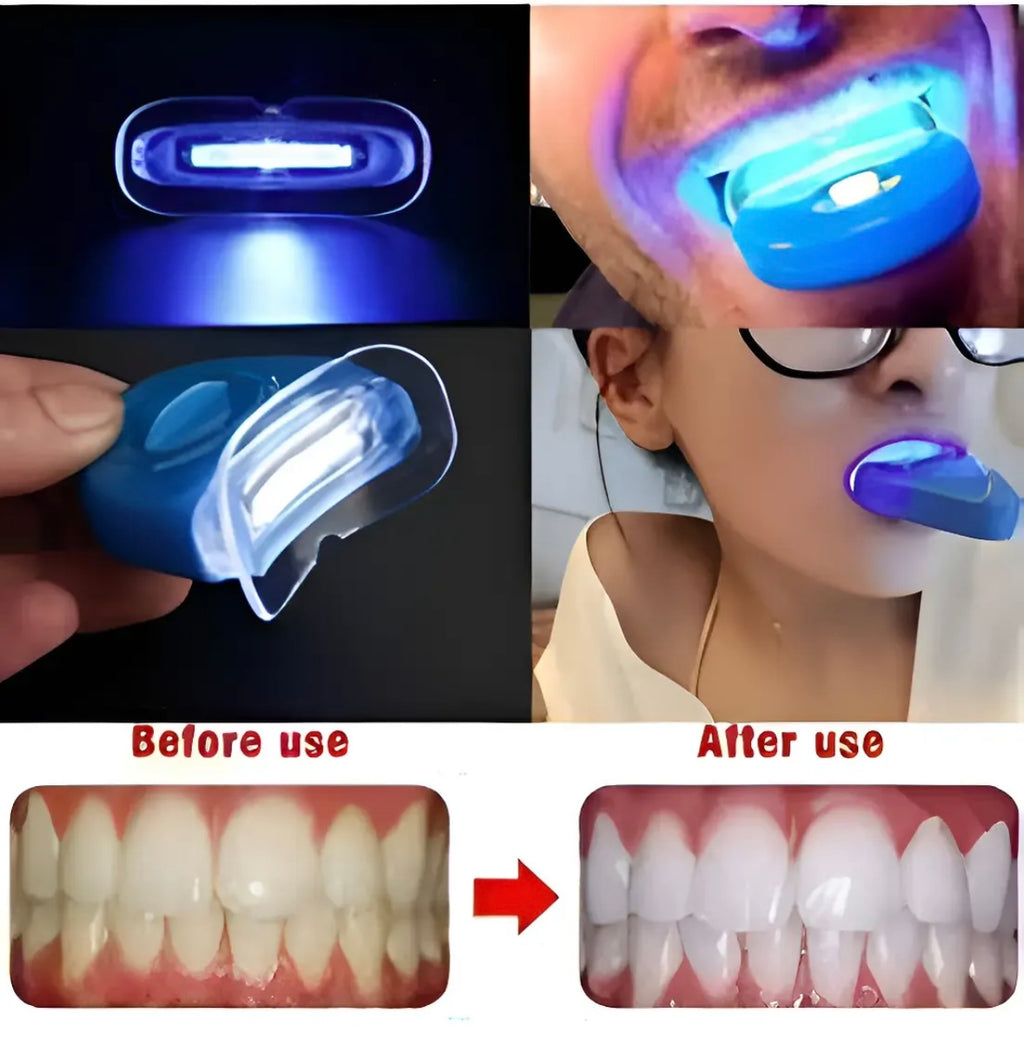 Fynex™ Kit Blanqueador Dental